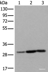 Western blot analysis of Human heart tissue A431 cell Human fetal liver tissue lysates using SNRPA Polyclonal Antibody at dilution of 1:550
