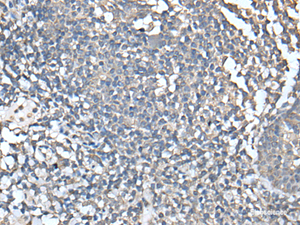 Immunohistochemistry of paraffin-embedded Human tonsil tissue using UBASH3A Polyclonal Antibody at dilution of 1:50 (×200)