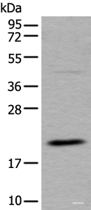 Western blot analysis of RAW264.7 cell lysate using UFC1 Polyclonal Antibody at dilution of 1:500