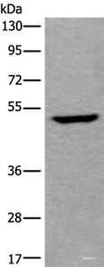 Western blot analysis of Human fetal liver tissue lysate using UMPS Polyclonal Antibody at dilution of 1:400