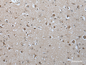 Immunohistochemistry of paraffin-embedded Human brain tissue using USP35 Polyclonal Antibody at dilution of 1:55 (×200)