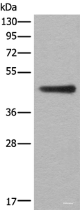 Western blot analysis of A431 cell lysate using ASS1 Polyclonal Antibody at dilution of 1:300