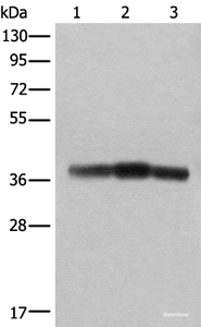 Western blot analysis of Rat brain tissue Mouse brain tissue and Human cerebrum tissue lysates using ATAD1 Polyclonal Antibody at dilution of 1:800