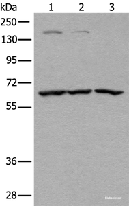 Western blot analysis of Raji Hela and A431 cell lysates using ATAD3A Polyclonal Antibody at dilution of 1:400