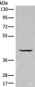 Western blot analysis of Human kidney tissue lysate using BBOX1 Polyclonal Antibody at dilution of 1:650