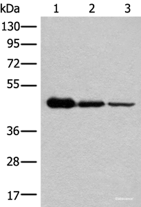 Western blot analysis of HEPG2 Hela and A549 cell lysates using NADK2 Polyclonal Antibody at dilution of 1:600
