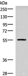 Western blot analysis of Human cerebella tissue lysate using CAMKK1 Polyclonal Antibody at dilution of 1:700