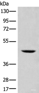 Western blot analysis of 293T cell lysate using SHPK Polyclonal Antibody at dilution of 1:500