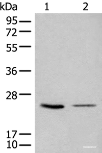 Western blot analysis of 293T and LOVO cell lysates using CDCA4 Polyclonal Antibody at dilution of 1:1000