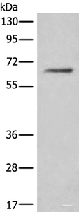 Western blot analysis of Hela cell lysate using CEP57 Polyclonal Antibody at dilution of 1:450