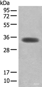 Western blot analysis of Mouse skeletal muscle tissue lysate using MYOZ2 Polyclonal Antibody at dilution of 1:450