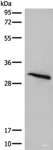 Western blot analysis of Mouse lung tissue lysate using ITM2B Polyclonal Antibody at dilution of 1:400