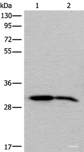 Western blot analysis of Human cerebrum tissue and Mouse brain tissue lysates using IMPA1 Polyclonal Antibody at dilution of 1:300