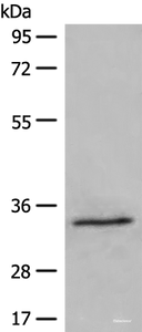 Western blot analysis of 231 cell lysate using DIMT1 Polyclonal Antibody at dilution of 1:500