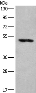 Western blot analysis of Human placenta tissue lysate using KLHDC2 Polyclonal Antibody at dilution of 1:400