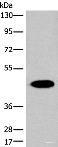 Western blot analysis of Human liver tissue lysate using FAH Polyclonal Antibody at dilution of 1:700