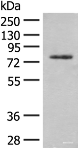 Western blot analysis of Hela cell lysate using TRMT1 Polyclonal Antibody at dilution of 1:300