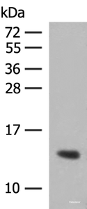 Western blot analysis of Human plasma solution using HBG1:HBG2 Polyclonal Antibody at dilution of 1:350