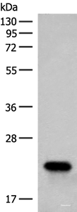 Western blot analysis of Human fetal brain tissue lysate using RAC3 Polyclonal Antibody at dilution of 1:400