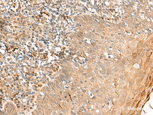 Immunohistochemistry of paraffin-embedded Human tonsil tissue using ZNF397 Polyclonal Antibody at dilution of 1:45 (×200)
