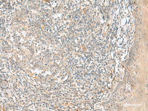 Immunohistochemistry of paraffin-embedded Human tonsil tissue using TTLL1 Polyclonal Antibody at dilution of 1:90 (×200)