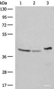 Western blot analysis of SKOV3 Hela and HepG2 cell lysates using ERAL1 Polyclonal Antibody at dilution of 1:500