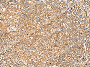 Immunohistochemistry of paraffin-embedded Human tonsil tissue using FNTB Polyclonal Antibody at dilution of 1:35 (×200)