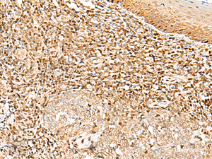 Immunohistochemistry of paraffin-embedded Human tonsil tissue using DNPEP Polyclonal Antibody at dilution of 1:30 (×200)