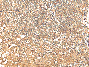 Immunohistochemistry of paraffin-embedded Human tonsil tissue using PWP1 Polyclonal Antibody at dilution of 1:50 (×200)