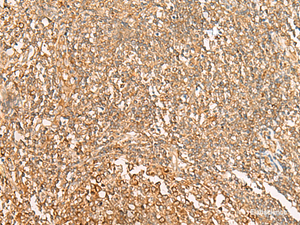Immunohistochemistry of paraffin-embedded Human tonsil tissue using NARS Polyclonal Antibody at dilution of 1:30 (×200)