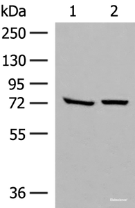 Western blot analysis of HepG2 and A172 cell lysates using POMGNT1 Polyclonal Antibody at dilution of 1:250