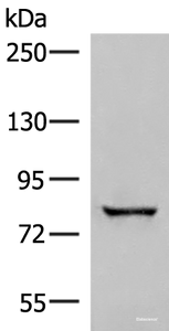 Western blot analysis of Human bladder transitional cell carcinoma grade 2-3 tissue lysate using TTC12 Polyclonal Antibody at dilution of 1:300