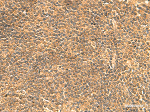 Immunohistochemistry of paraffin-embedded Human tonsil tissue using FAM186B Polyclonal Antibody at dilution of 1:25 (×200)