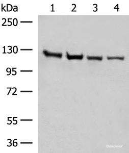 Western blot analysis of Human fetal brain tissue K562 cell Hela and A172 cell lysates using IPO11 Polyclonal Antibody at dilution of 1:450