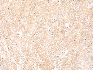 Immunohistochemistry of paraffin-embedded Human brain tissue using EMC1 Polyclonal Antibody at dilution of 1:35 (×200)
