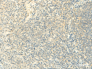 Immunohistochemistry of paraffin-embedded Human tonsil tissue using FMNL2 Polyclonal Antibody at dilution of 1:50 (×200)
