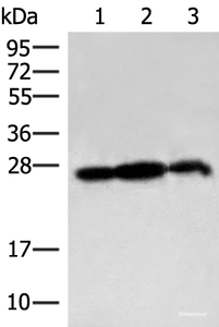 Western blot analysis of 293T cell and Rat brain tissue lysates using PDAP1 Polyclonal Antibody at dilution of 1:400