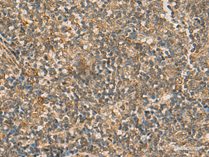 Immunohistochemistry of paraffin-embedded Human tonsil tissue using IFT22 Polyclonal Antibody at dilution of 1:50 (×200)