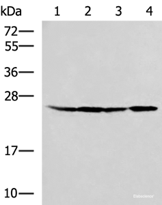 Western blot analysis of HT29 A549 Hela and LOVO cell lysates using RPL13A Polyclonal Antibody at dilution of 1:1000