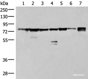 Western blot analysis of 231 K562 TM4 cell Mouse kidney tissue Mouse liver tissue Mouse brain tissue Hela cell lysates using THNSL1 Polyclonal Antibody at dilution of 1:500