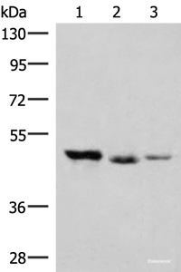 Western blot analysis of K562 and Jurkat cell Mouse kidney tissue lysates using HMBOX1 Polyclonal Antibody at dilution of 1:500