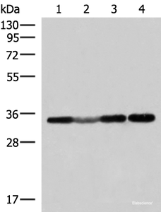 Western blot analysis of 293T and Hela cell Human fetal liver tissue lysates using ECH1 Polyclonal Antibody at dilution of 1:300