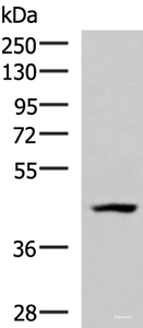 Western blot analysis of 293T cell lysate using MAGEC2 Polyclonal Antibody at dilution of 1:700