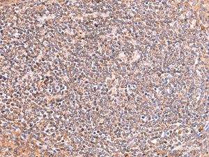 Immunohistochemistry of paraffin-embedded Human tonsil tissue using PHKG2 Polyclonal Antibody at dilution of 1:60 (×200)