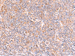 Immunohistochemistry of paraffin-embedded Human tonsil tissue using NADK Polyclonal Antibody at dilution of 1:95 (×200)