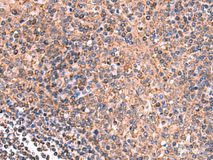 Immunohistochemistry of paraffin-embedded Human tonsil tissue using GALK2 Polyclonal Antibody at dilution of 1:160 (×200)