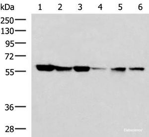 Western blot analysis of 293T 231 K562 Jurkat and Hela cell lysates using FKBP4 Polyclonal Antibody at dilution of 1:700