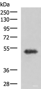 Western blot analysis of Human fetal brain tissue lysate using TSEN2 Polyclonal Antibody at dilution of 1:1000