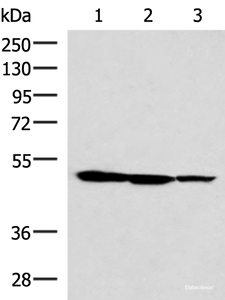 Western blot analysis of HepG2 K562 and A172 cell lysates using TTC38 Polyclonal Antibody at dilution of 1:1000