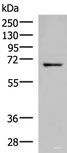 Western blot analysis of 231 cell lysate using GSPT2 Polyclonal Antibody at dilution of 1:650